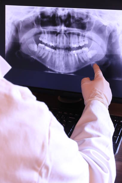Best Emergency Dentist for Knocked-Out Tooth in Grenelefe, FL